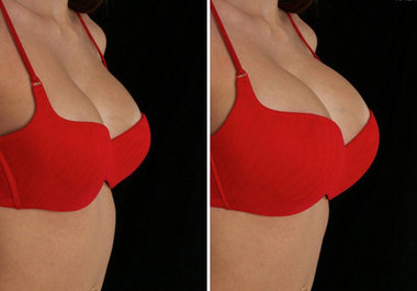 show you how you would look if you had plastic surgery big2