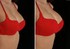 show you how you would look if you had plastic surgery small2