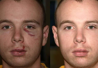 professionally retouch your photo in 1 day big2
