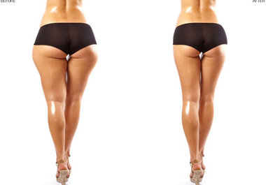 show you how you would look if you had plastic surgery big3