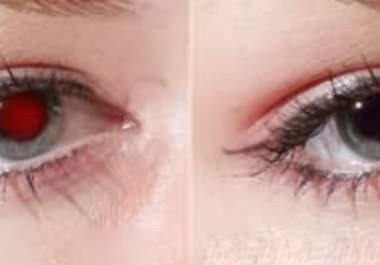 remove red eye effect in up to 3 photos big3