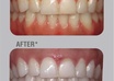 give you any dental advice