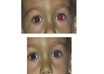 erase the red eye from your picture