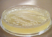 Petri-dish-2
