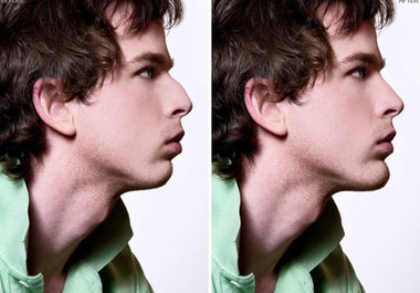 show you how you would look if you had plastic surgery big1
