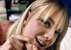send You My Guide to solve your acne problem