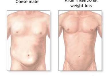 let u know how you can burn 5 kg in a week without a gym big1