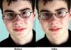 remove acne, scars and other skin impurities from your picture using Photoshop small1