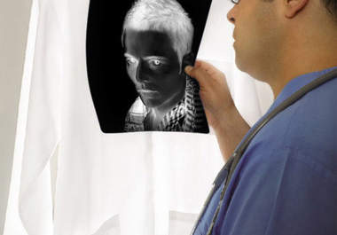 send you a picture of doctor holding your xray film big1