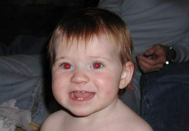 remove Red Eye Effect Up To 15 Photos Within 24 Hours big1