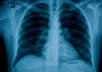 answer any questions about you Medical/Diagnostic test