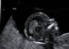 answer questions about your recent or upcoming sonogram