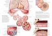 show you all you want to know about Chronic Obstructive Pulmonary Disease