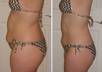 provide you with before and after pictures and more